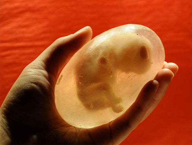 fetus_soap